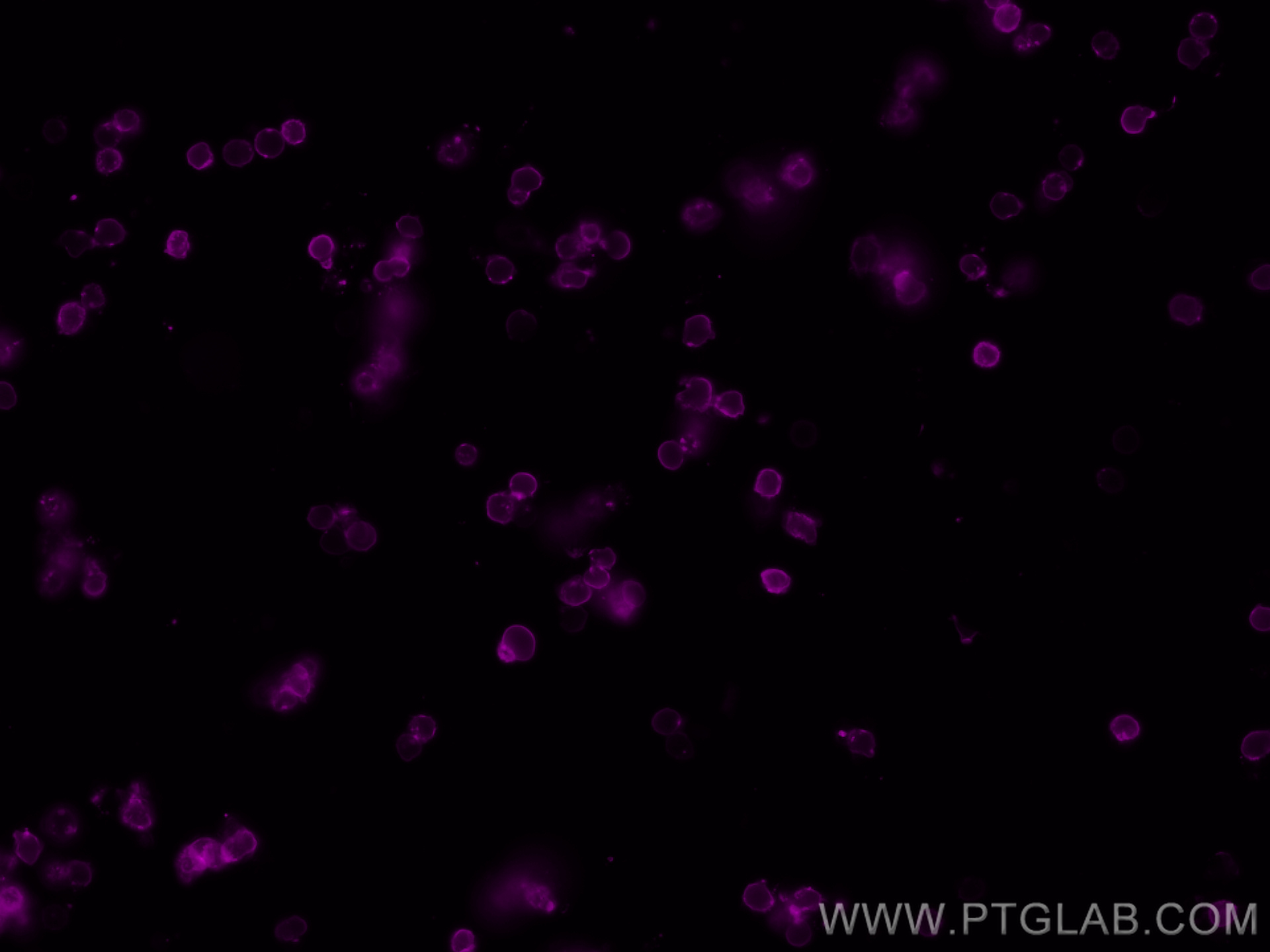 IF Staining of mouse splenocytes using CL647-65088