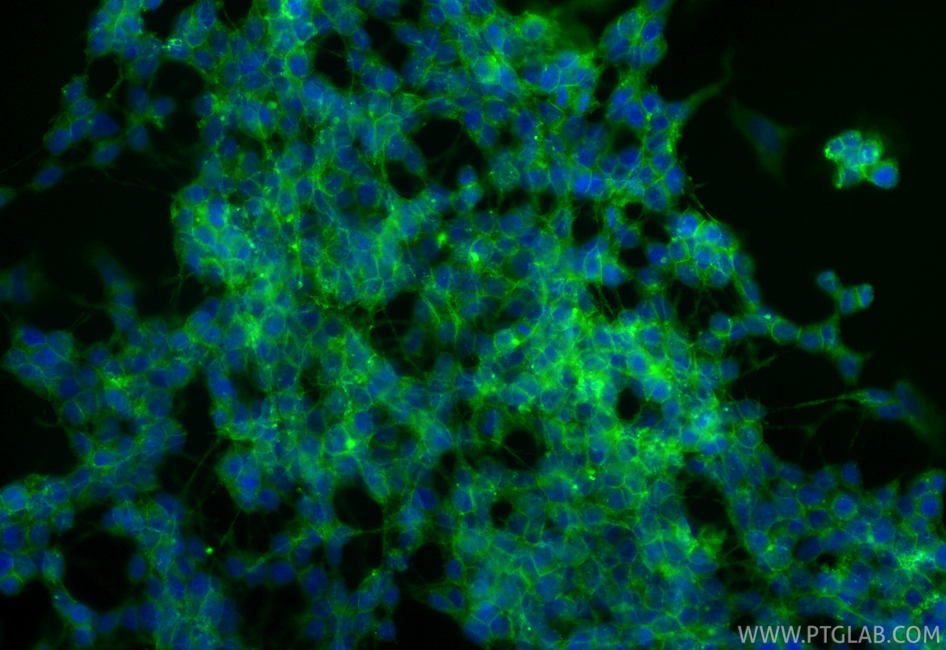 Immunofluorescent analysis of (-20°C Ethanol) fixed SH-SY5Y cells using CoraLite® Plus 488 CD90 antibody (CL488-84180, Clone: 241290B1 ) at dilution of 1:200. IF Staining of SH-SY5Y using CL488-84180