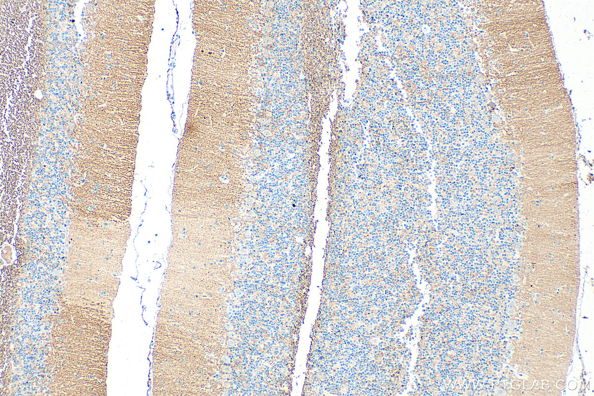 IHC staining of rat cerebellum using 31949-1-AP