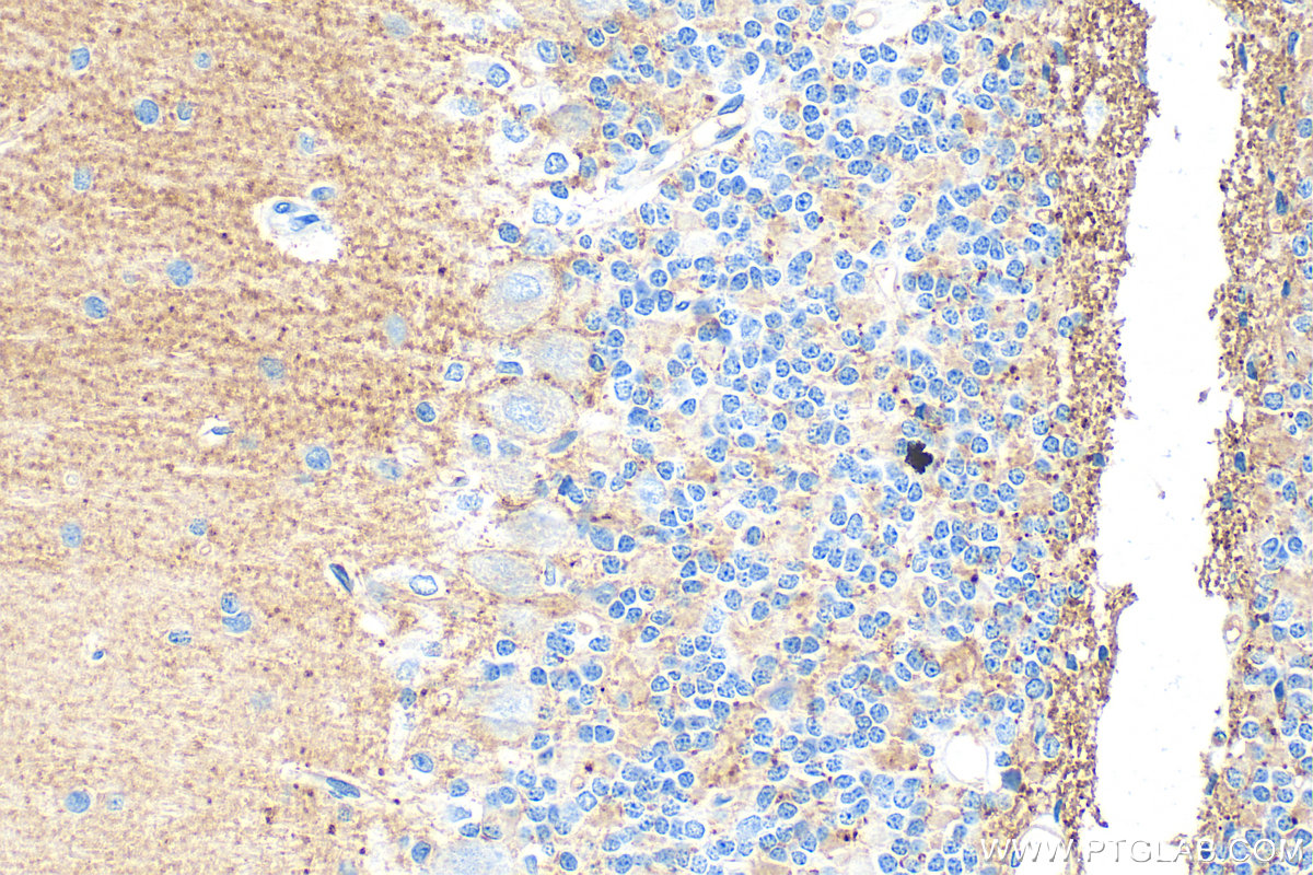 IHC staining of rat cerebellum using 31949-1-AP