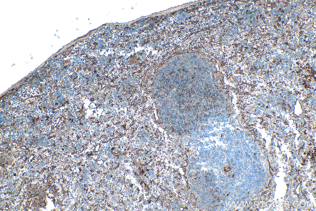 IHC staining of mouse spleen using 33313-1-AP IHC staining of mouse spleen using 33313-1-AP