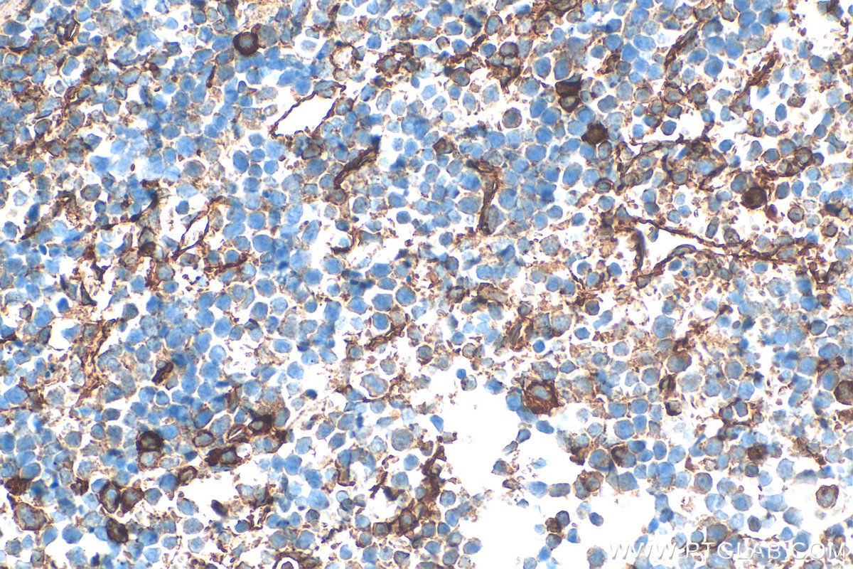 IHC staining of mouse spleen using 33313-1-AP IHC staining of mouse spleen using 33313-1-AP