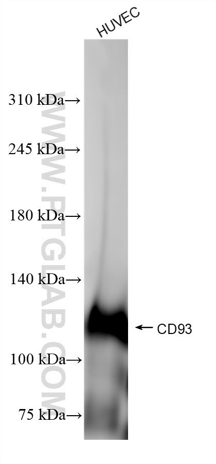 WB analysis of HUVEC using 84945-4-RR (same clone as 84945-4-PBS)