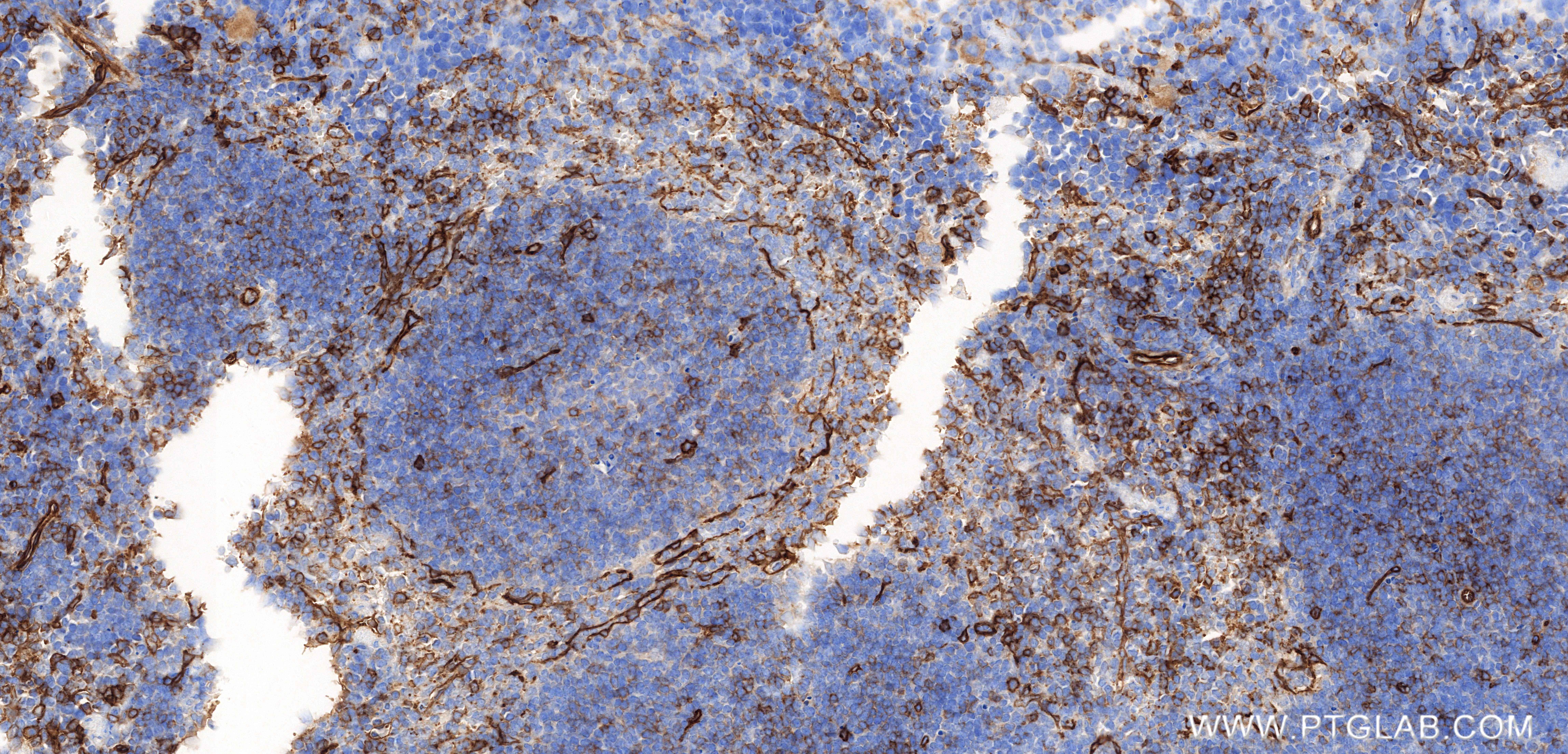 IHC staining of mouse spleen using 86071-4-RR (same clone as 86071-4-PBS)
