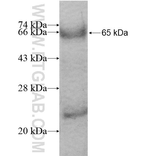 CD93 fusion protein Ag13132 SDS-PAGE