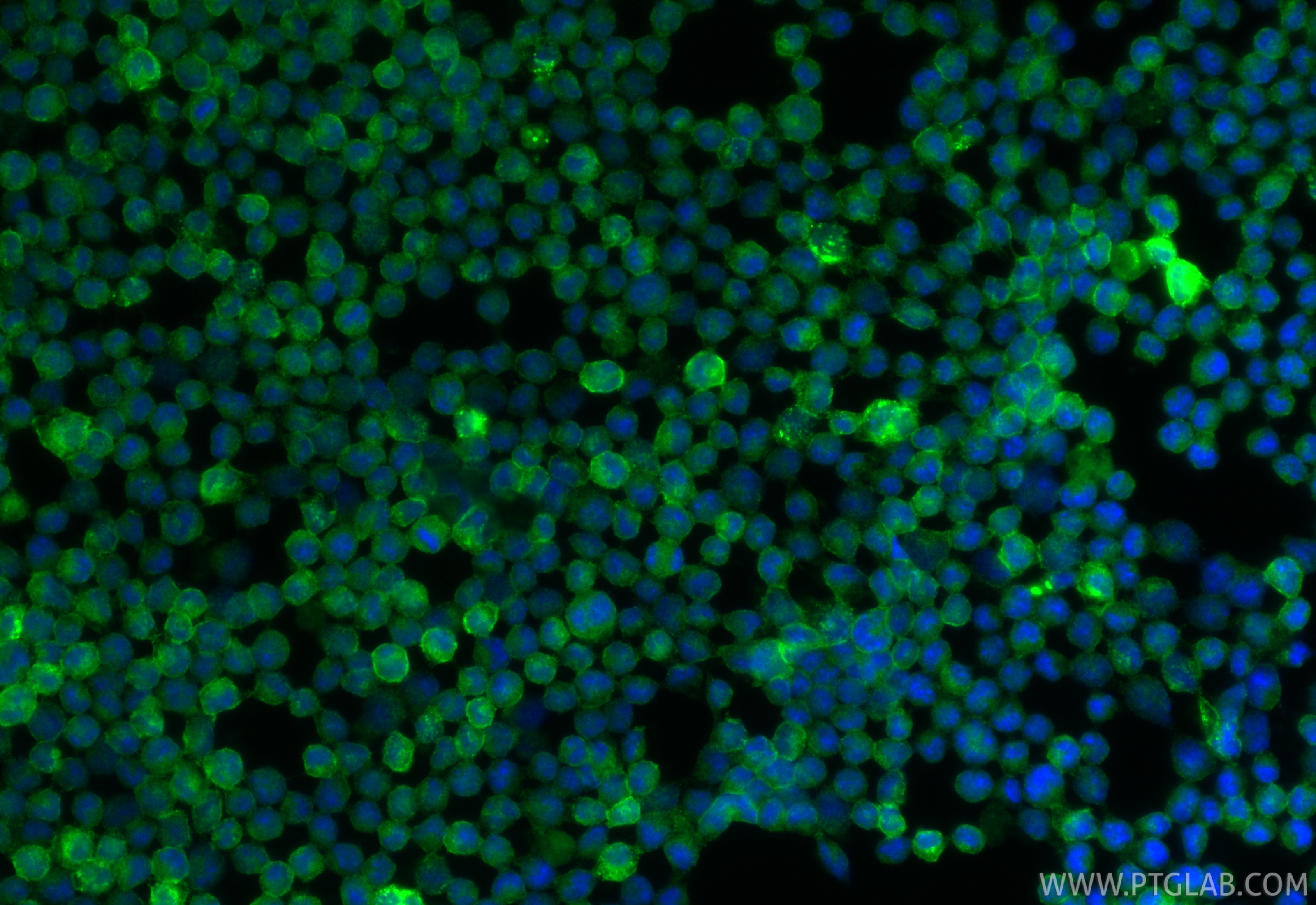 IF Staining of CTLL-2 using 34031-1-AP IF Staining of CTLL-2 using 34031-1-AP