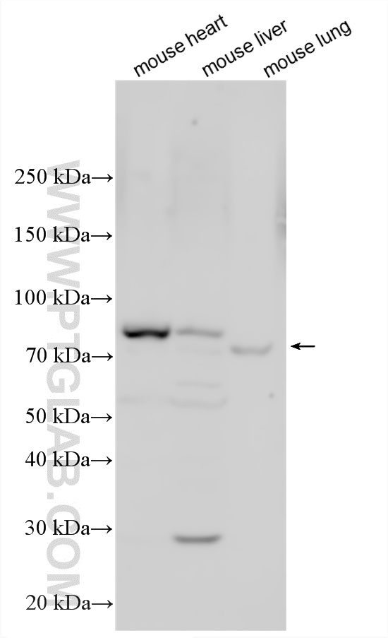 Various lysates were subjected to SDS PAGE followed by western blot with 34031-1-AP (CD96 antibody) at dilution of 1:800 incubated at room temperature for 1.5 hours. WB analysis using 34031-1-AP