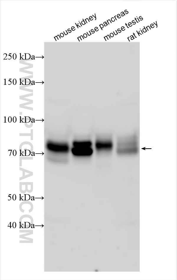 WB analysis using 31865-1-AP
