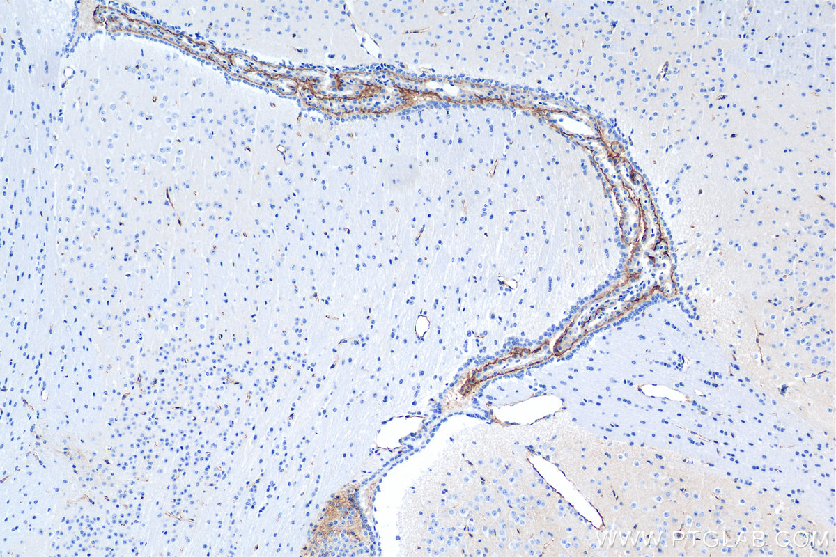 IHC staining of mouse brain using 84040-7-RR