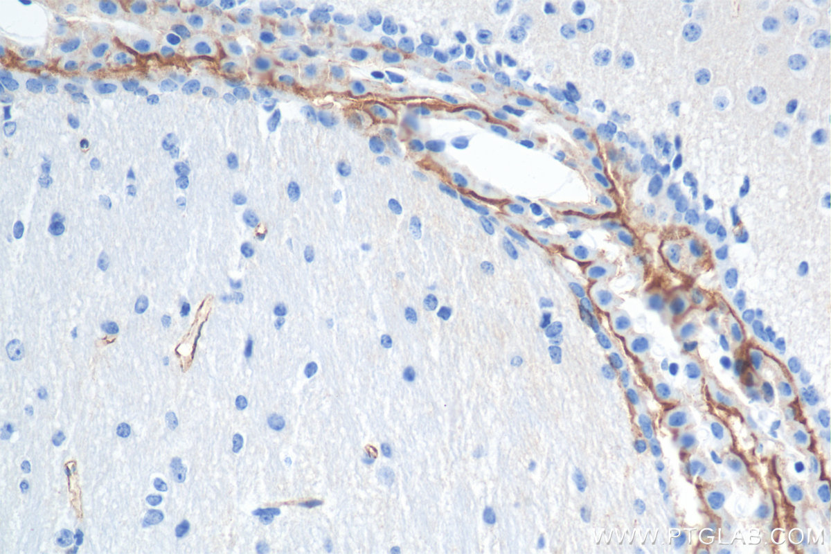 IHC staining of mouse brain using 84040-7-RR