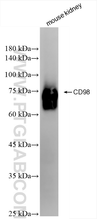 WB analysis of mouse kidney using 84040-7-RR