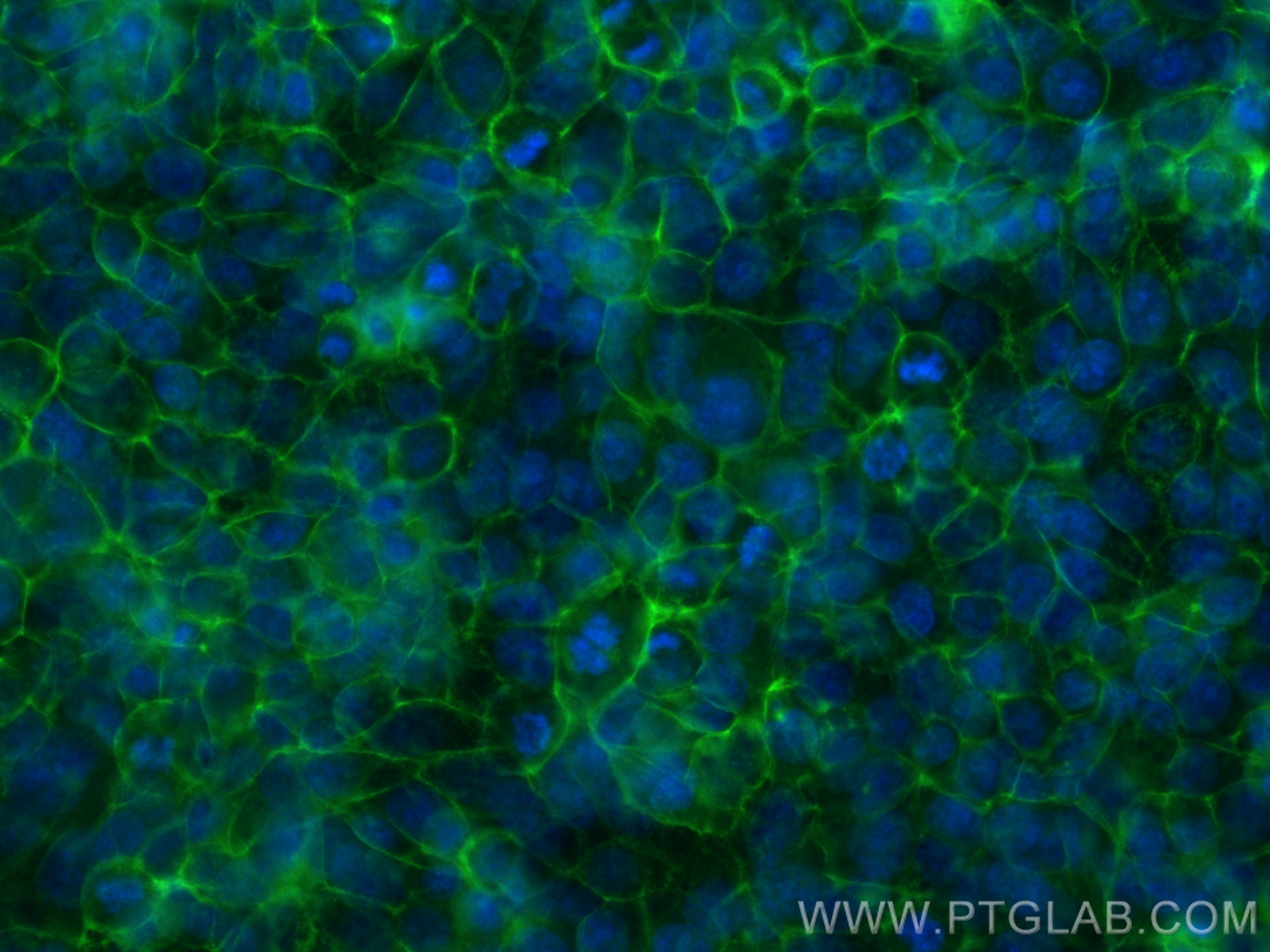 IF Staining of HepG2 using CL488-84387-6