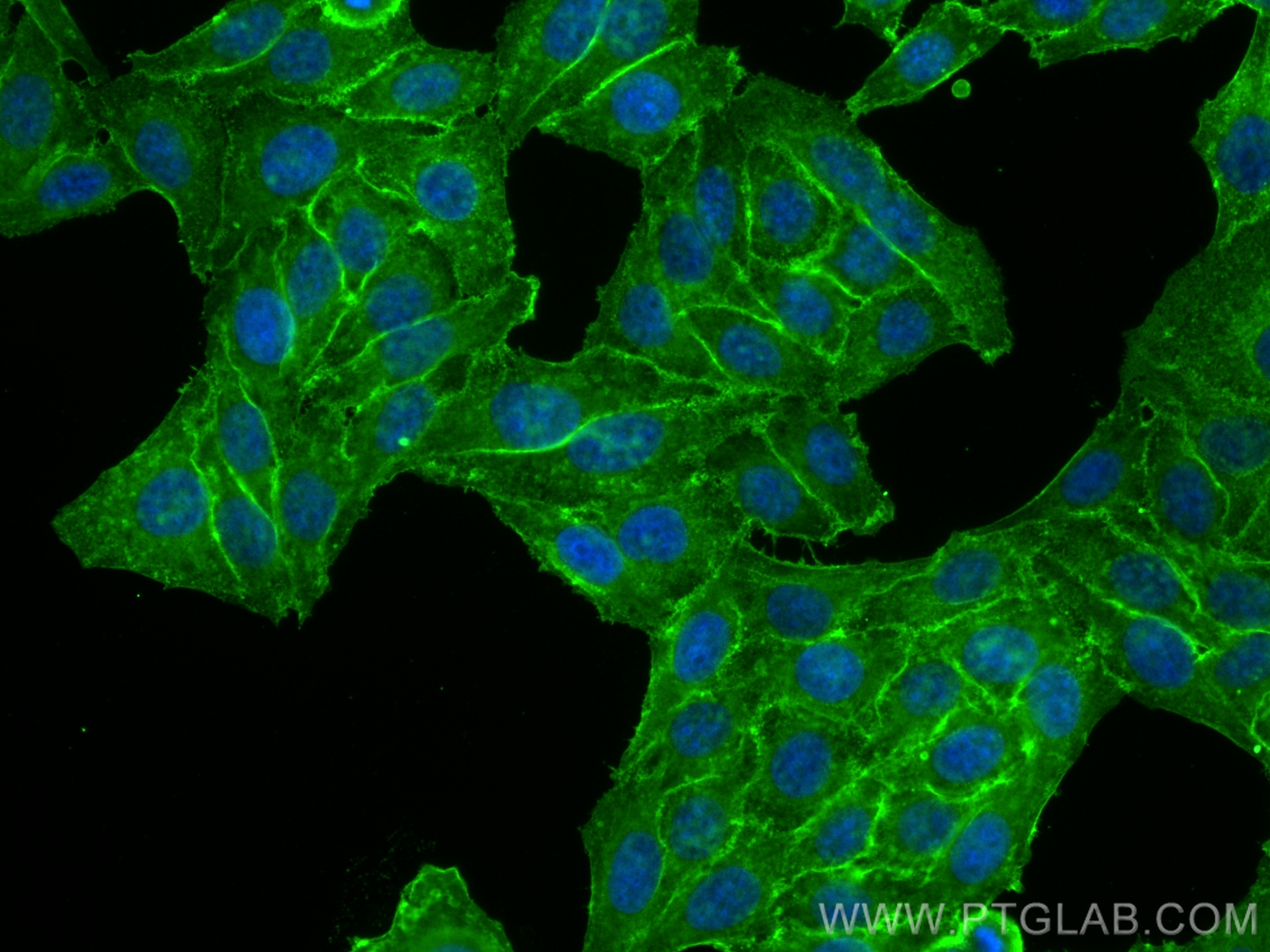 IF Staining of HepG2 using 32010-1-AP