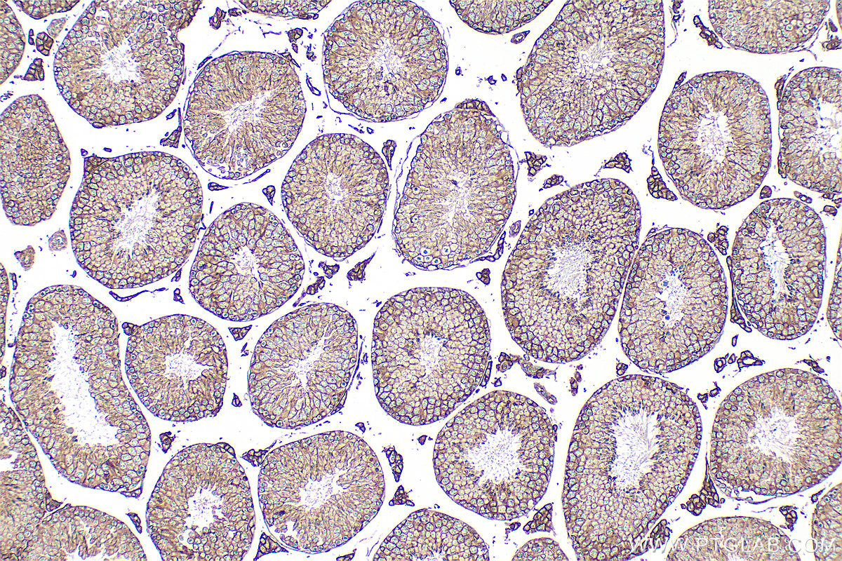 IHC staining of mouse testis using 32010-1-AP