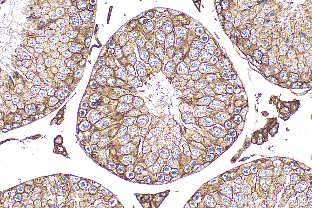IHC staining of mouse testis using 32010-1-AP