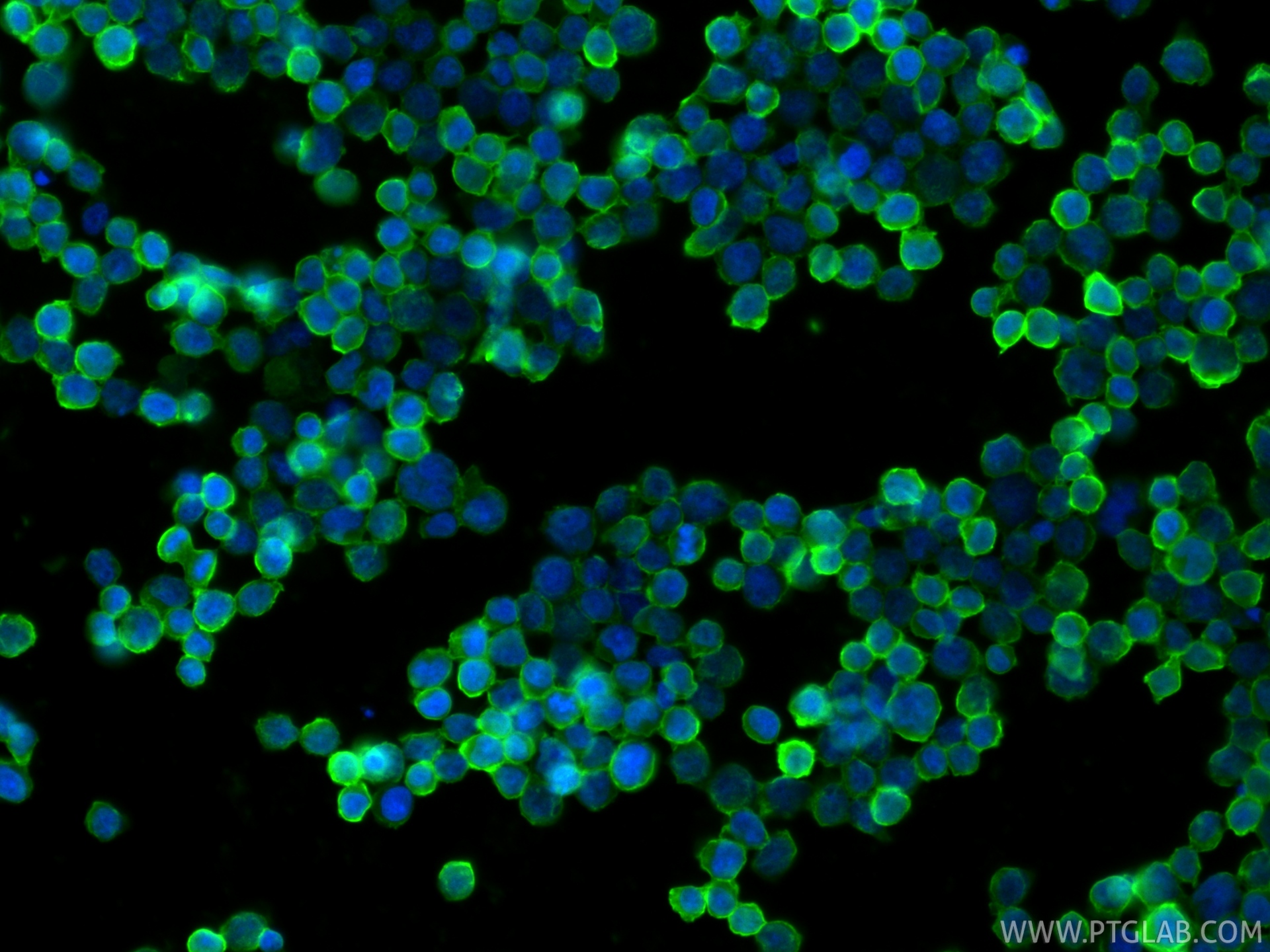 IF Staining of Jurkat using 23079-1-AP