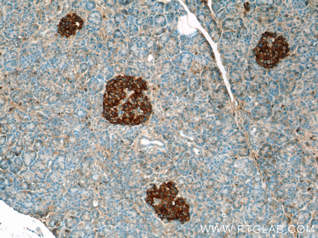 IHC staining of human pancreas using 23079-1-AP