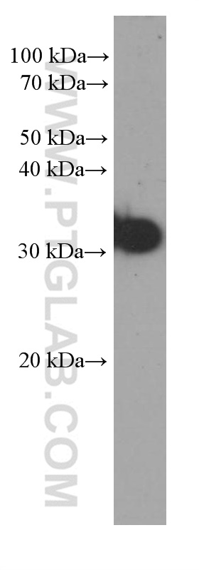 WB analysis of human spleen using 60354-1-Ig (same clone as 60354-1-PBS)