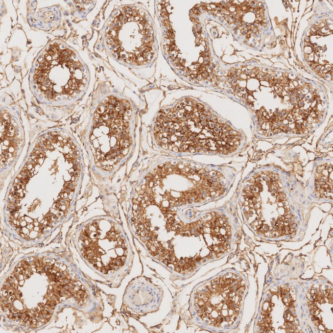 IHC staining of human testis using 84580-4-RR IHC staining of human testis using 84580-4-RR