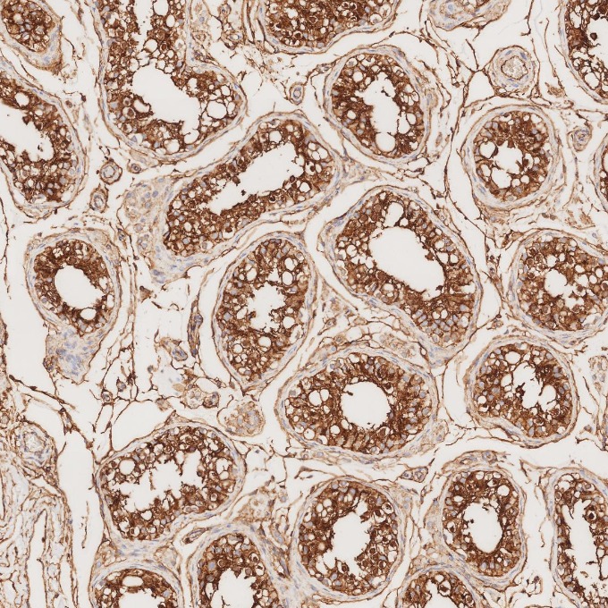 IHC staining of human testis using 84580-4-RR IHC staining of human testis using 84580-4-RR