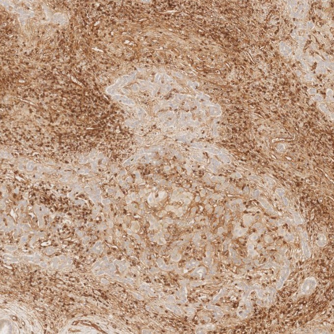 IHC staining of human liver using 84580-4-RR IHC staining of human liver using 84580-4-RR
