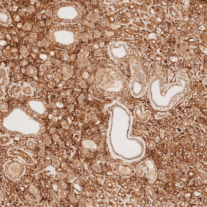 IHC staining of human kidney using 84580-4-RR IHC staining of human kidney using 84580-4-RR