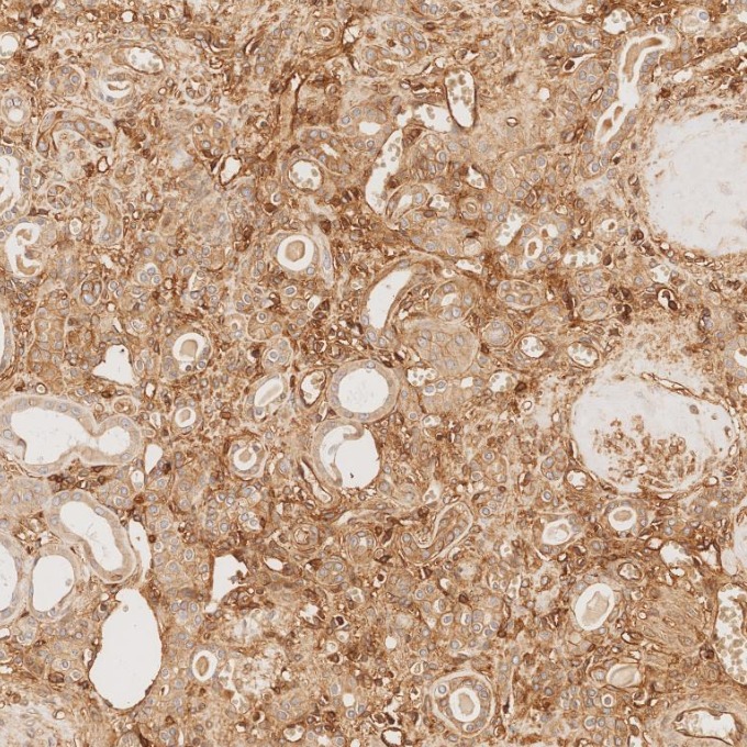 IHC staining of human kidney using 84580-4-RR IHC staining of human kidney using 84580-4-RR