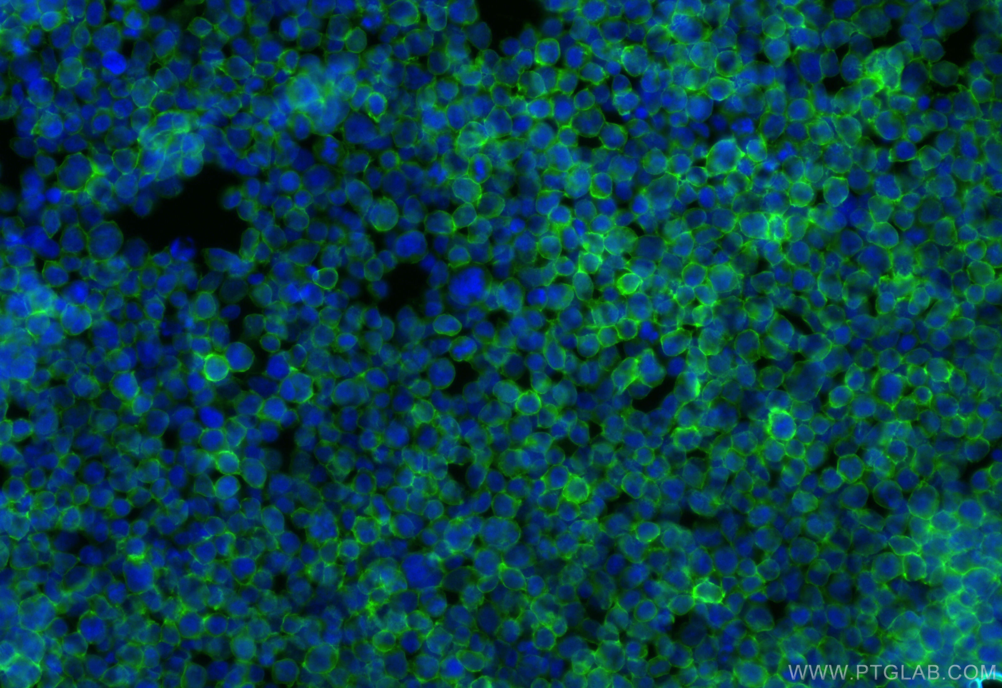 IF Staining of Jurkat using CL488-84580-4