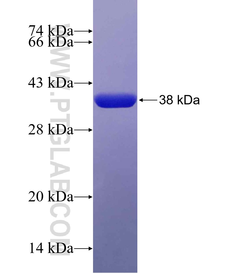 CD99 fusion protein Ag19461 SDS-PAGE