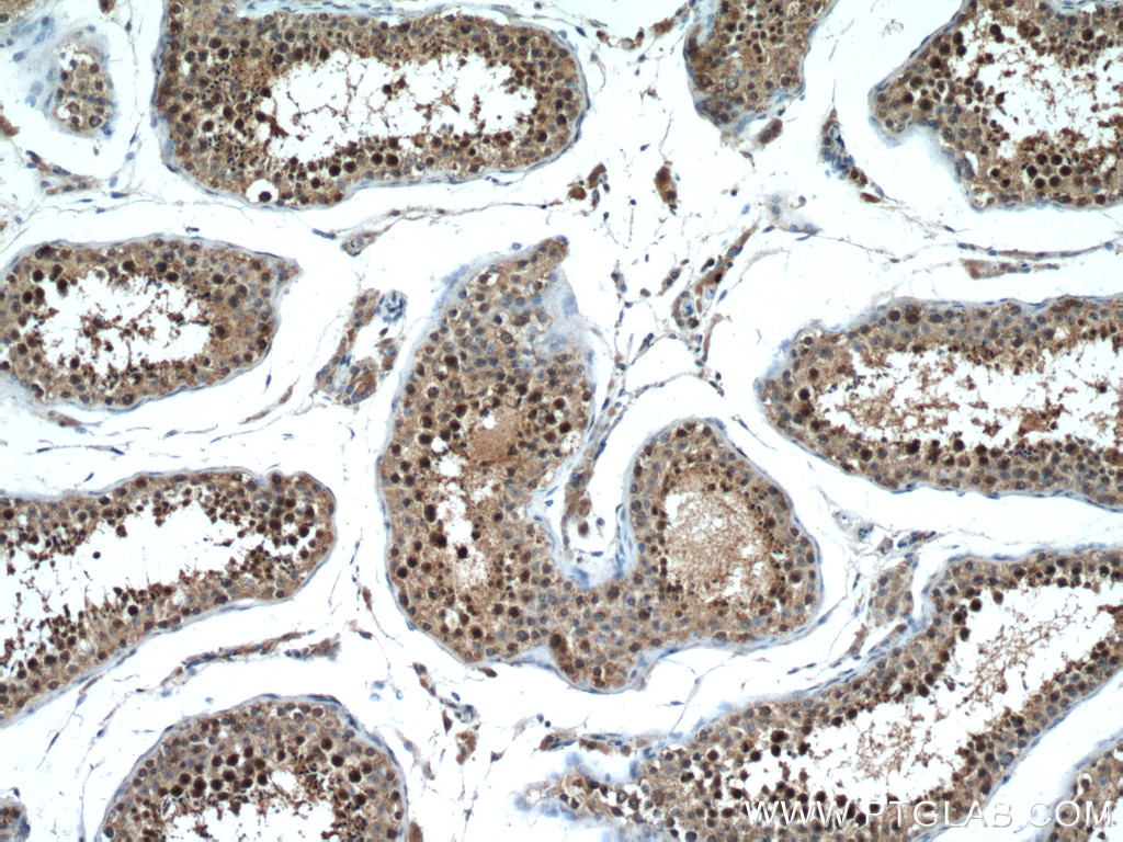 IHC staining of human testis using 28169-1-AP