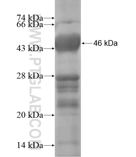 CDADC1 fusion protein Ag18999 SDS-PAGE CDADC1 fusion protein Ag18999 SDS-PAGE