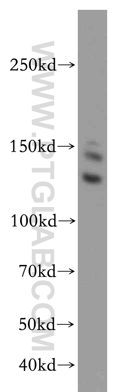 WB analysis of HeLa using 17597-1-AP