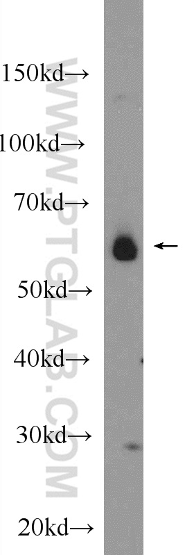 WB analysis of SMMC-7721 using 25187-1-AP