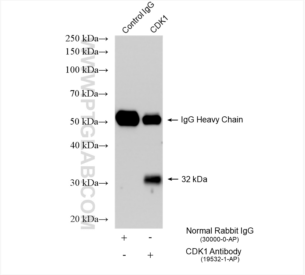 IP experiment of HEK-293 using 19532-1-AP