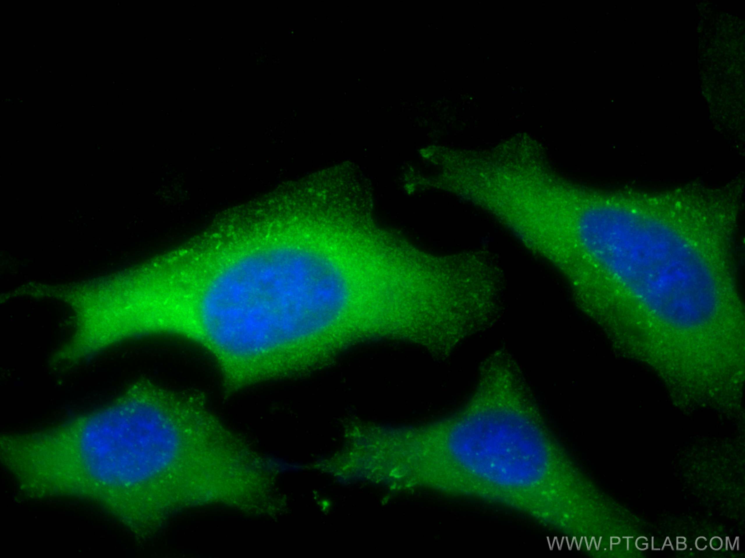 IF Staining of HeLa using 10252-1-AP