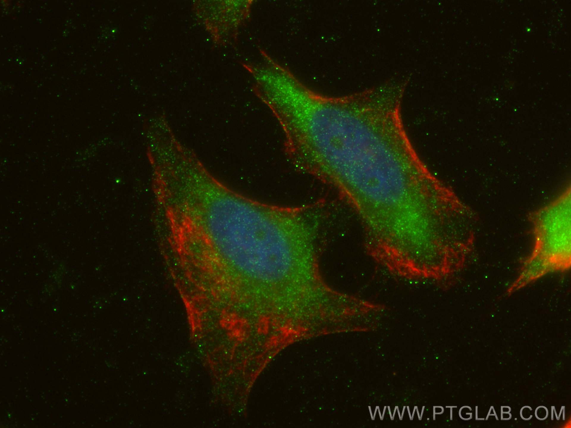 IF Staining of HeLa using 30451-1-AP