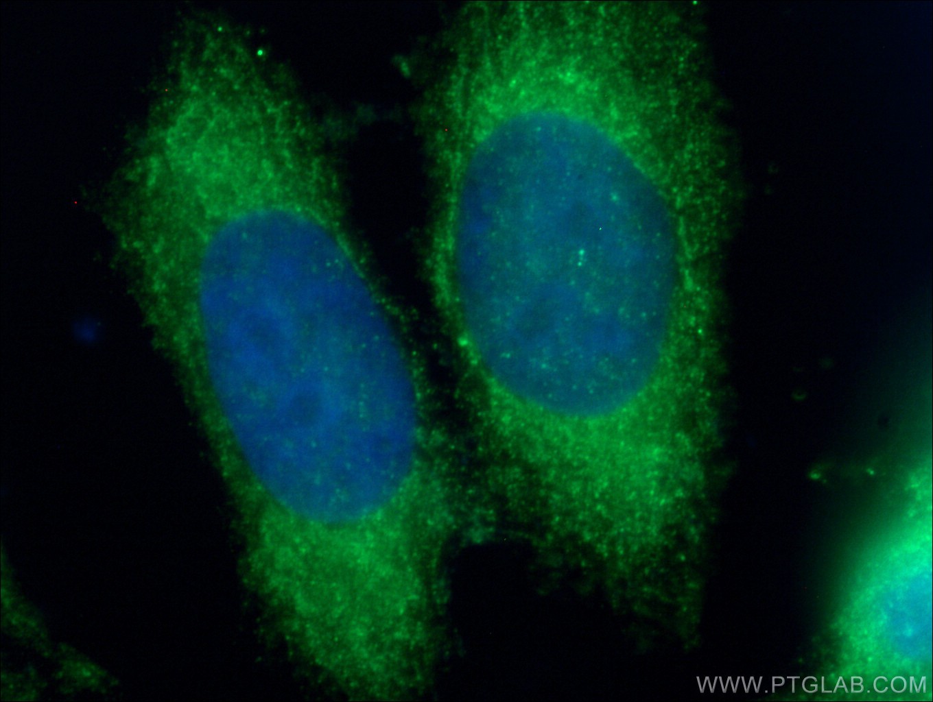 IF Staining of HeLa using 13376-1-AP