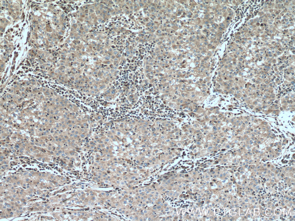 IHC staining of human kidney using 13376-1-AP