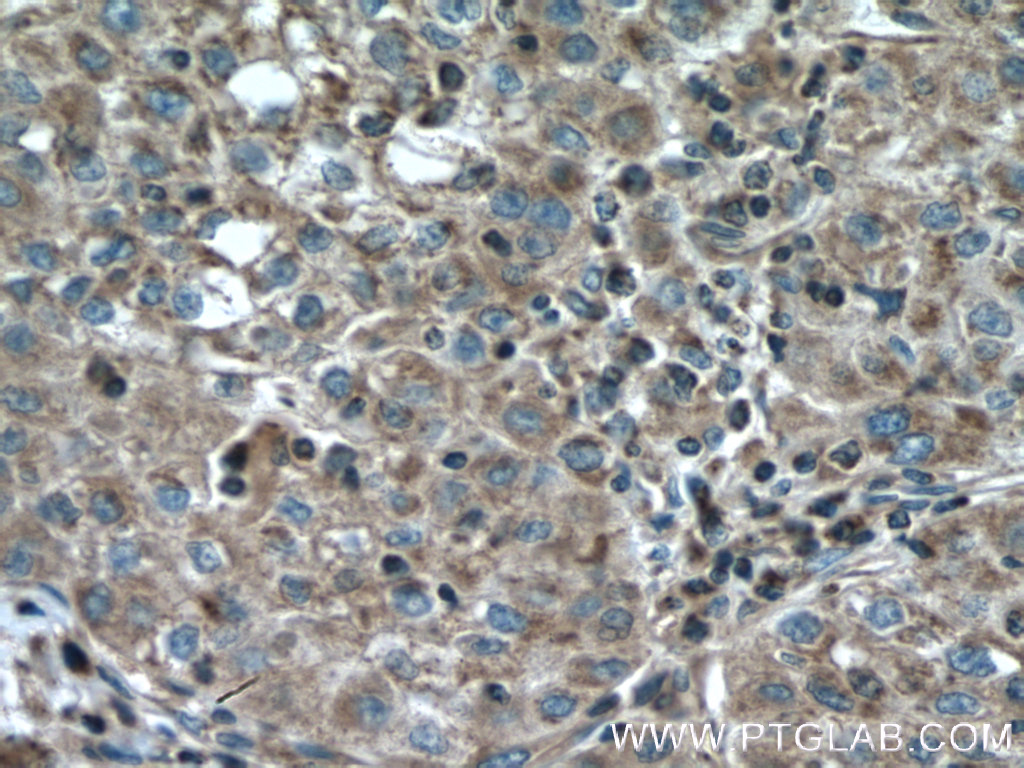 IHC staining of human kidney using 13376-1-AP