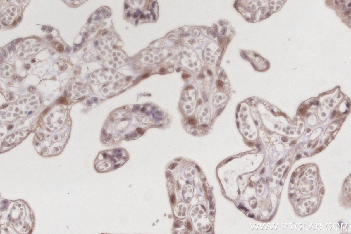 IHC staining of human placenta using 10683-1-AP