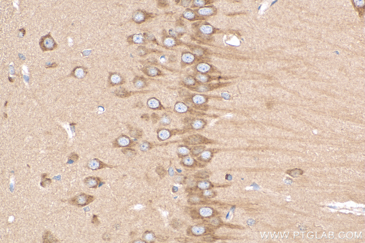 IHC staining of rat brain using 12958-1-AP