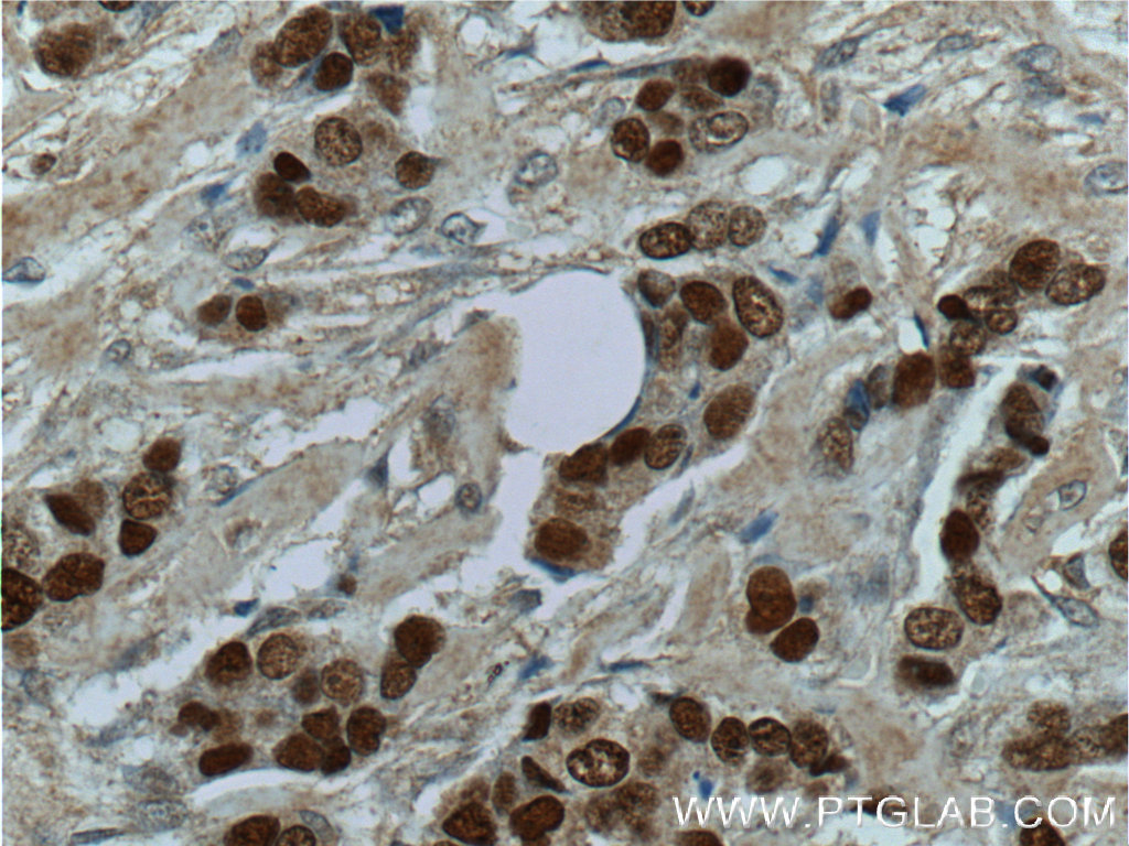 CDC25A Polyclonal antibody