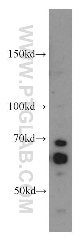 WB analysis of HepG2 using 55031-1-AP