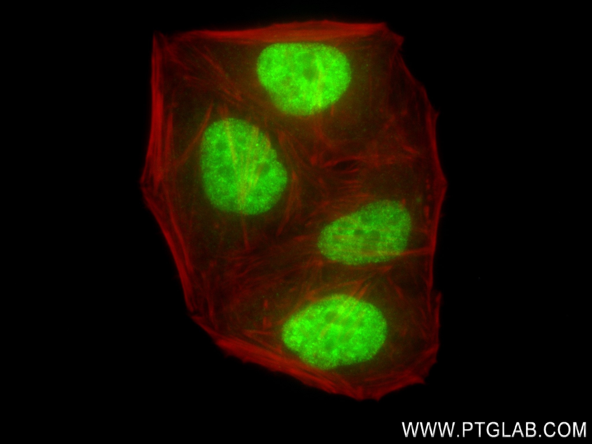 IF Staining of HepG2 using 84145-2-RR