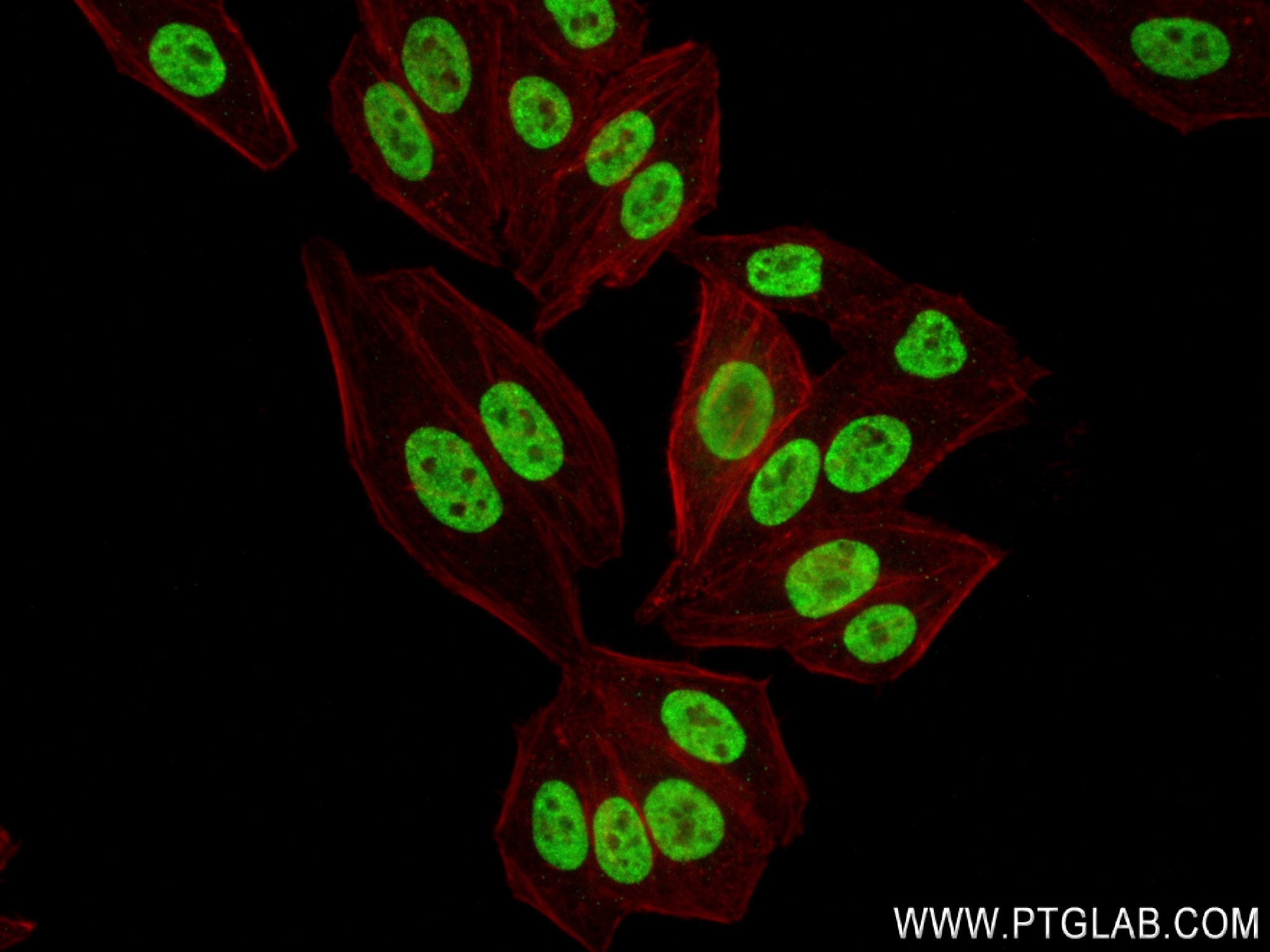 IF Staining of HepG2 using 84145-2-RR