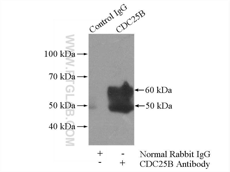 IP experiment of mouse liver using 10644-1-AP