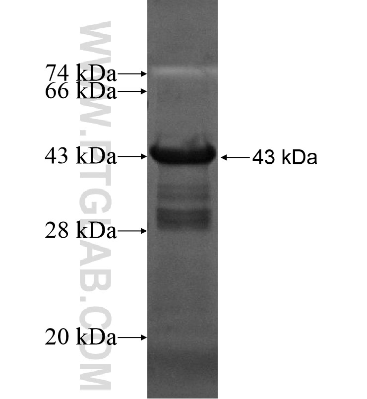 CDC25B fusion protein Ag16776 SDS-PAGE CDC25B fusion protein Ag16776 SDS-PAGE