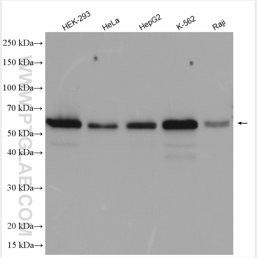 WB analysis using 16485-1-AP