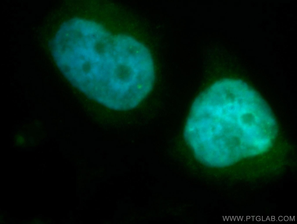 IF Staining of SH-SY5Y using 10918-1-AP