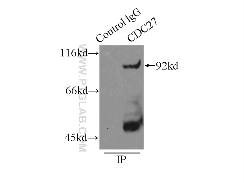 IP experiment of K-562 using 10918-1-AP